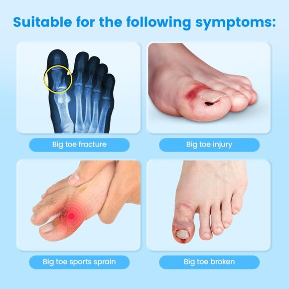 Broken Big Toe Splint Brace, Fracture Big  with 2 Stainless Steel Plate - Right - Picture 2 of 6